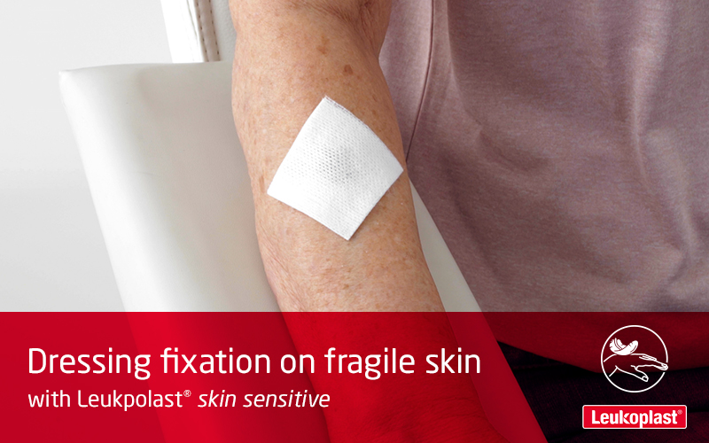 On voit ici comment appliquer et repositionner un pansement pour plaies sur la peau très sensible à l’aide d’un sparadrap médical : un professionnel de santé fixe une couverture de plaies sur l’avant-bras d’une femme âgée, en utilisant Leukoplast skin sensitive. On voit ici comment appliquer et repositionner un pansement pour plaies sur la peau très sensible à l’aide d’un sparadrap médical : un professionnel de santé fixe une couverture de plaies sur l’avant-bras d’une femme âgée, en utilisant Leukoplast skin sensitive.
